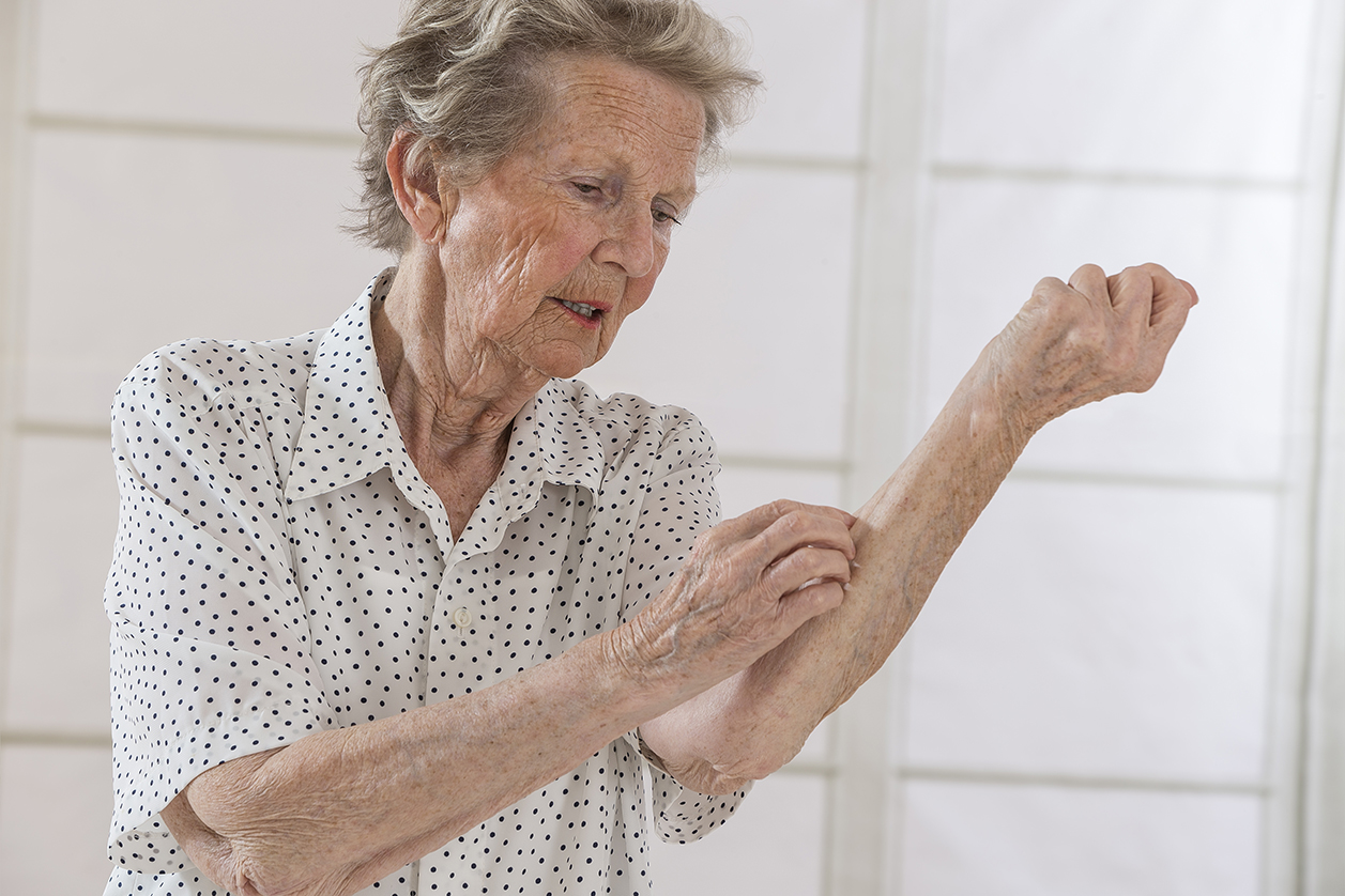 A senior woman scratching her arm.